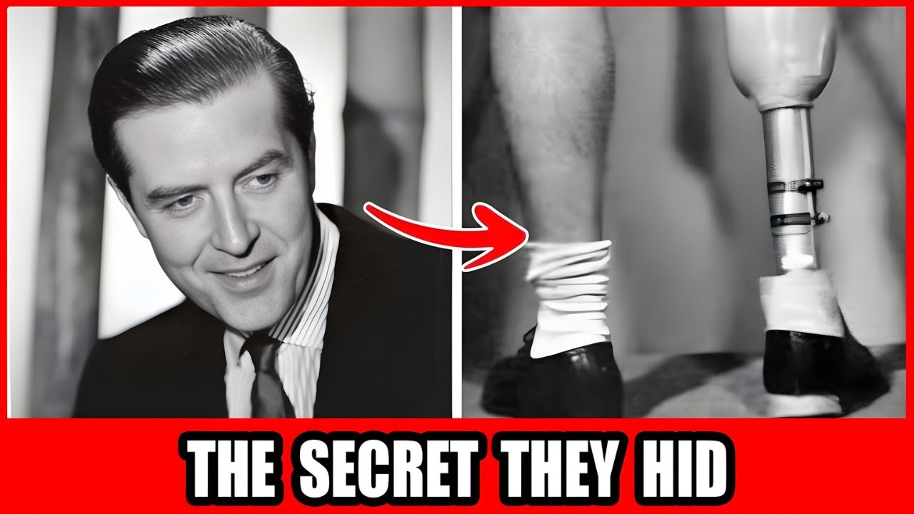 25 Golden Age Celebrities Who Hid Shocking Deformities And Disabilities!