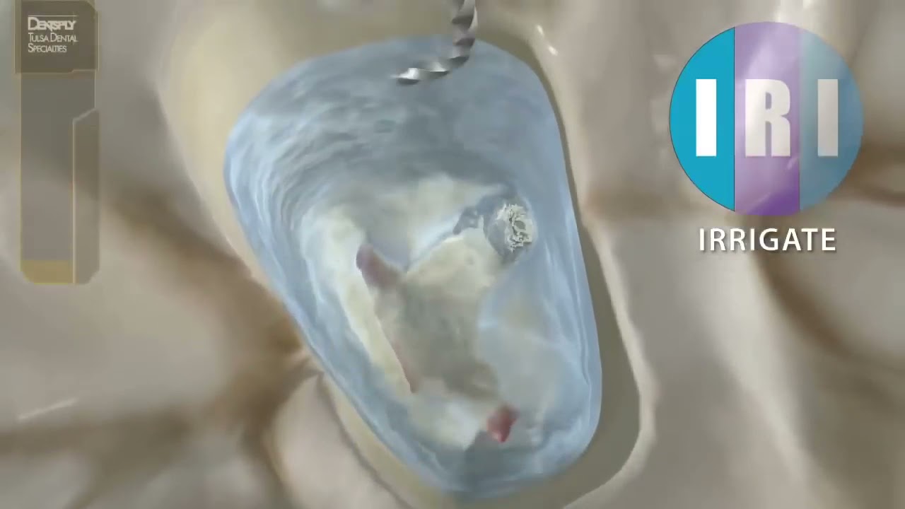 How to Use Protaper Gold Rotary File | pinkblue