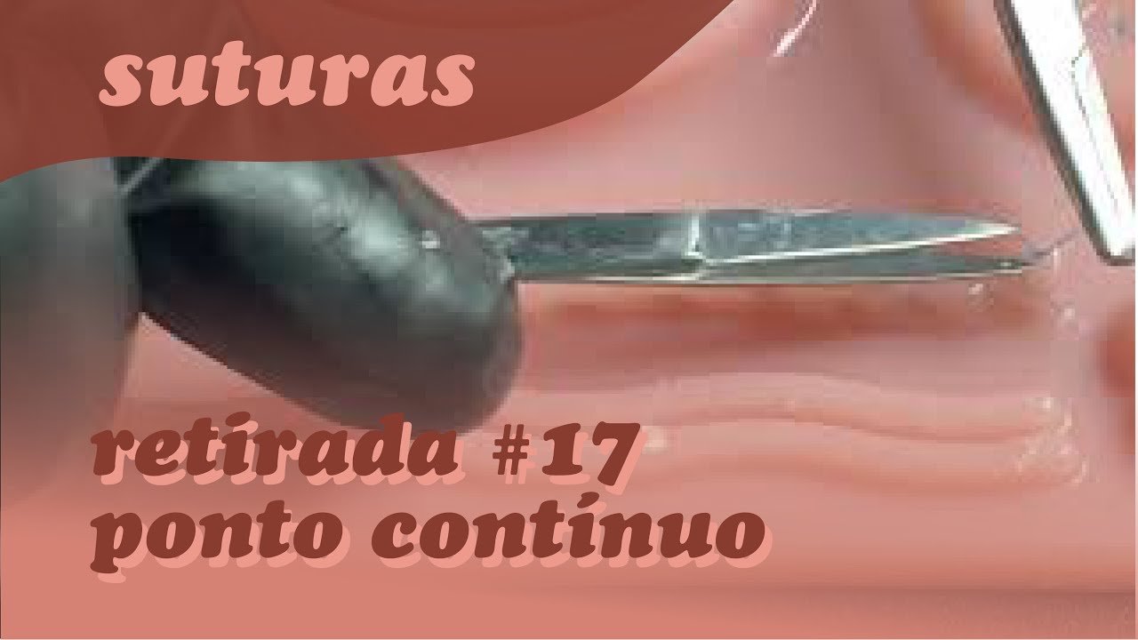 SUTURA | RETIRADA DE PONTO CONTÍNUO #17