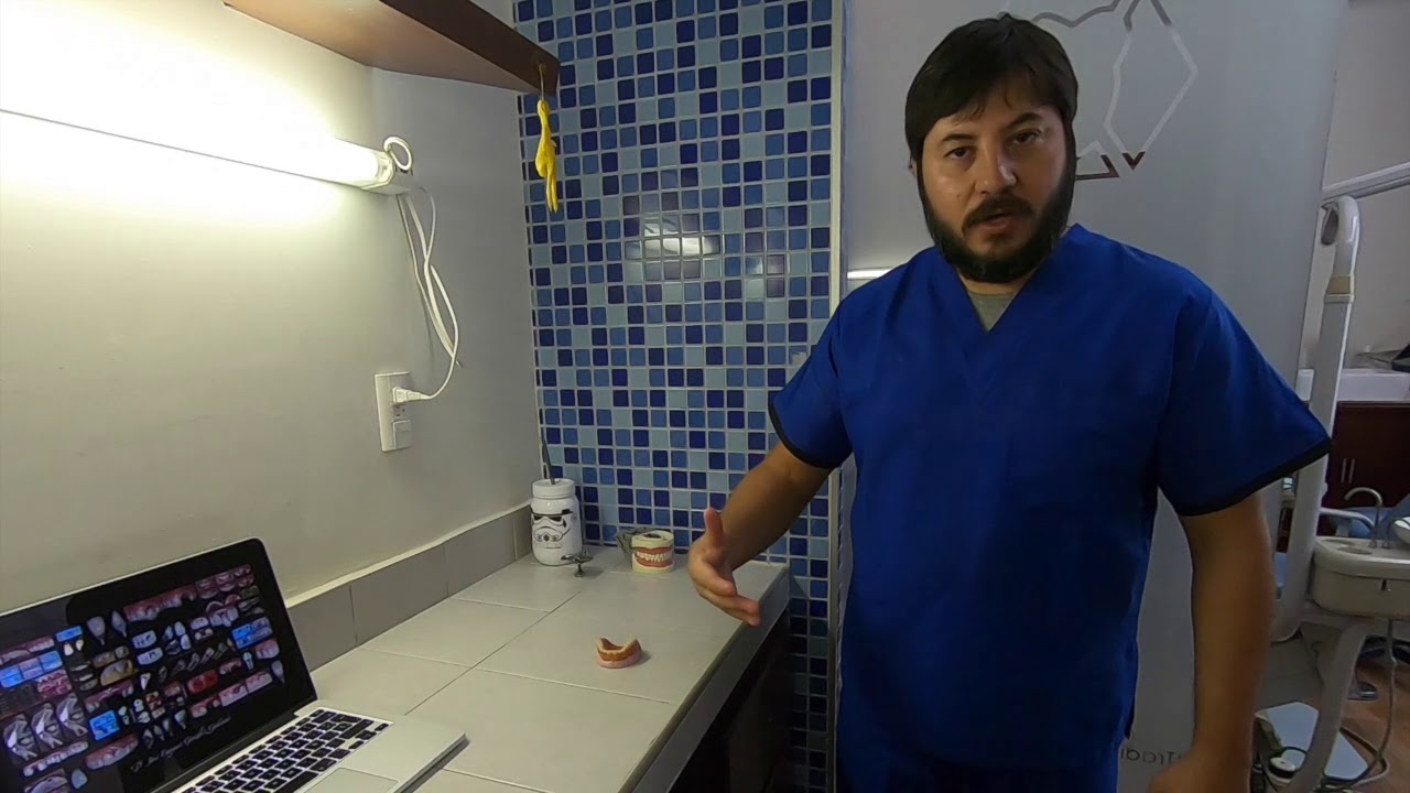 Reparación rápida y sencilla de una prótesis dental vieja fracturada.