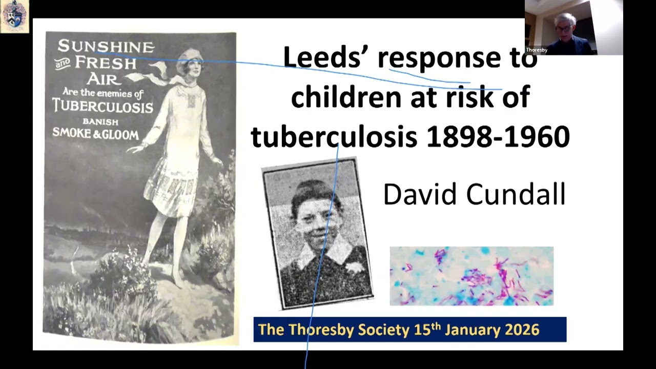 Leeds' response to children at risk of tuberculosis 1898-1960