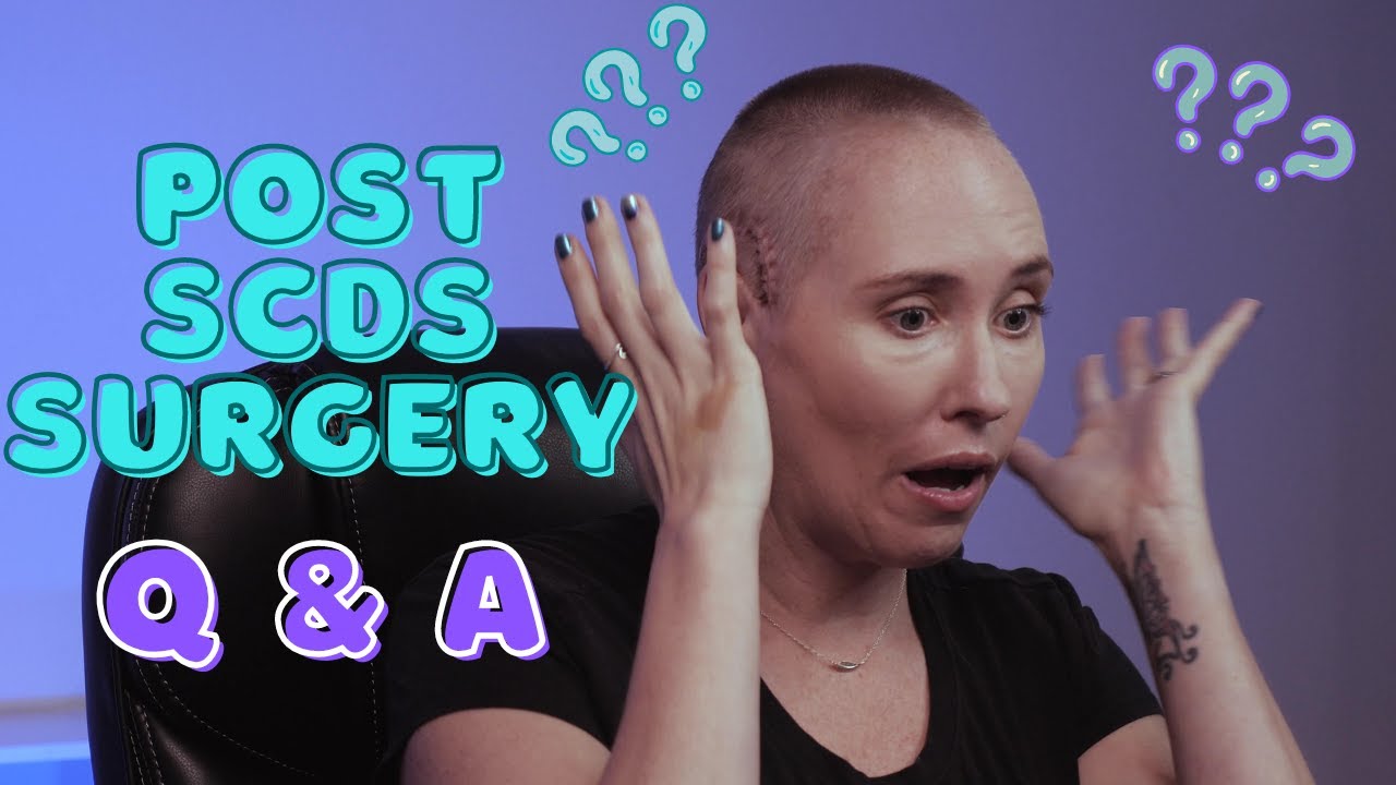 Post SCDS Surgery Q&A