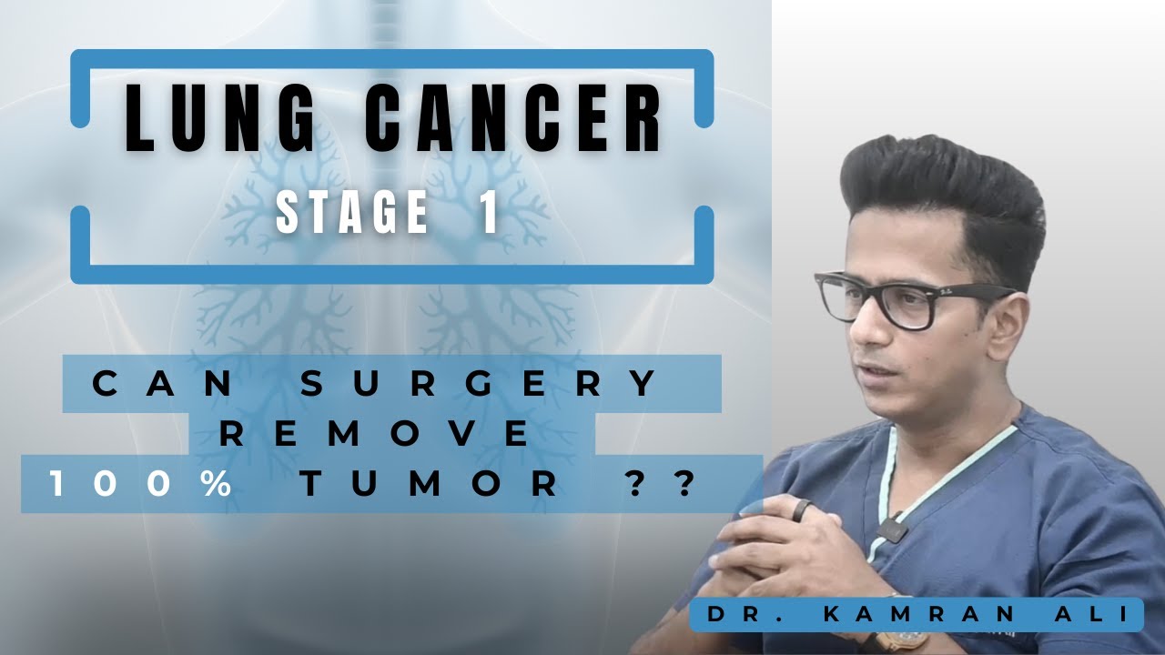 Stage 1 Lung Cancer: What You NEED to Know