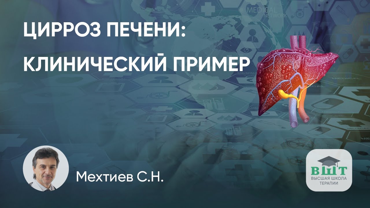 Оценка и ведение пациента с циррозом печени