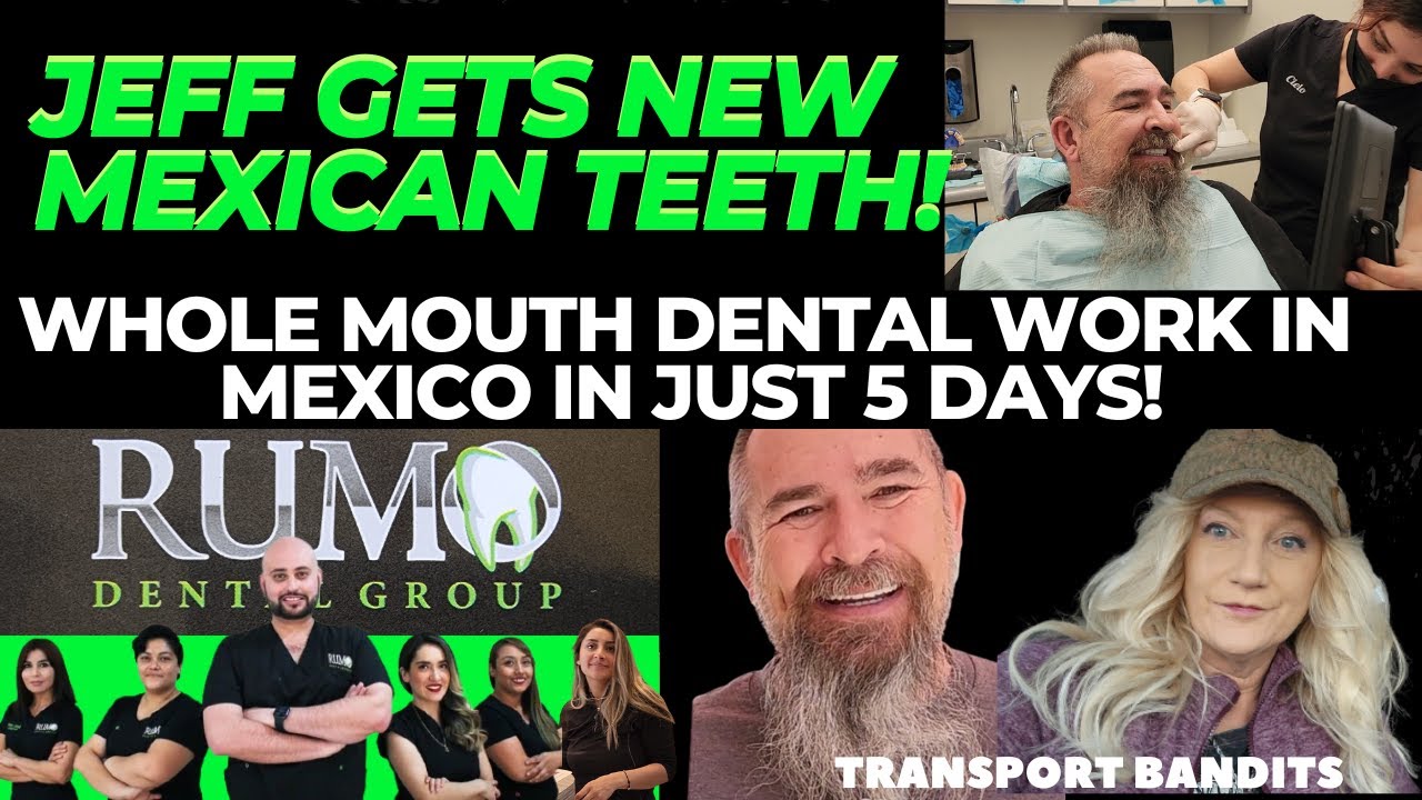 Jeff Gets New Mexican Teeth! Whole Mouth Dental Work Mexico!