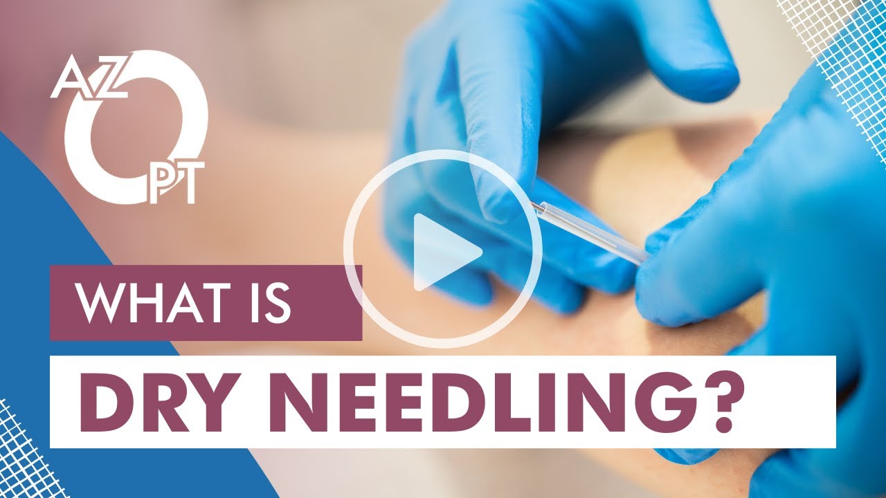 What is Dry Needling?