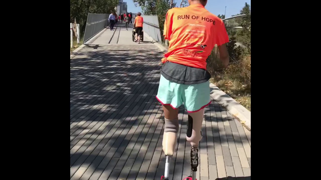 Quadruple amputee walked 5k for charity