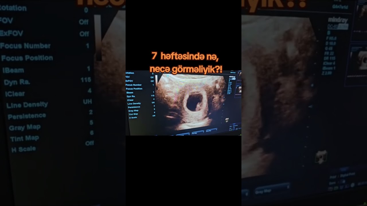 7 həftəsində nə, necə görməliyik?