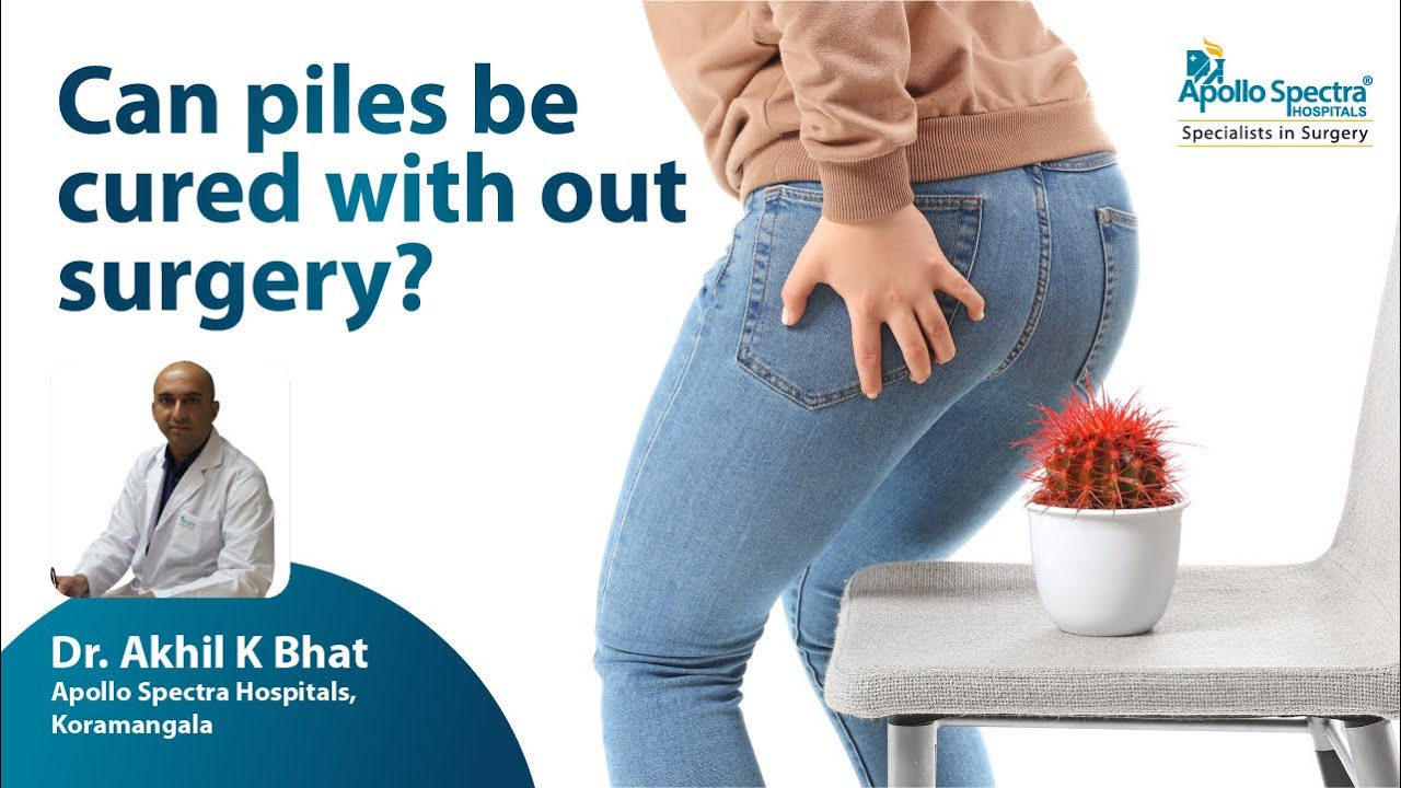 Questions & Answers on Piles Disease.
