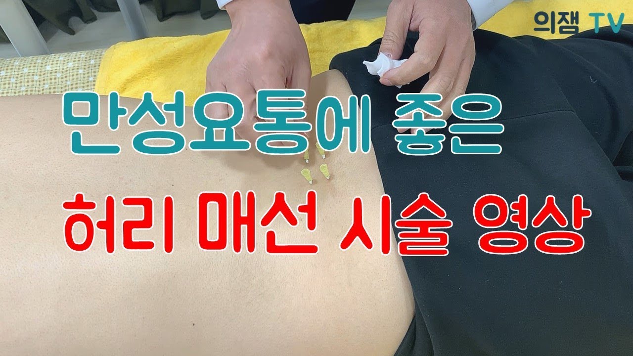 허리에 좋은 매선치료 설명과 시술영상 보여드리겠습니다!