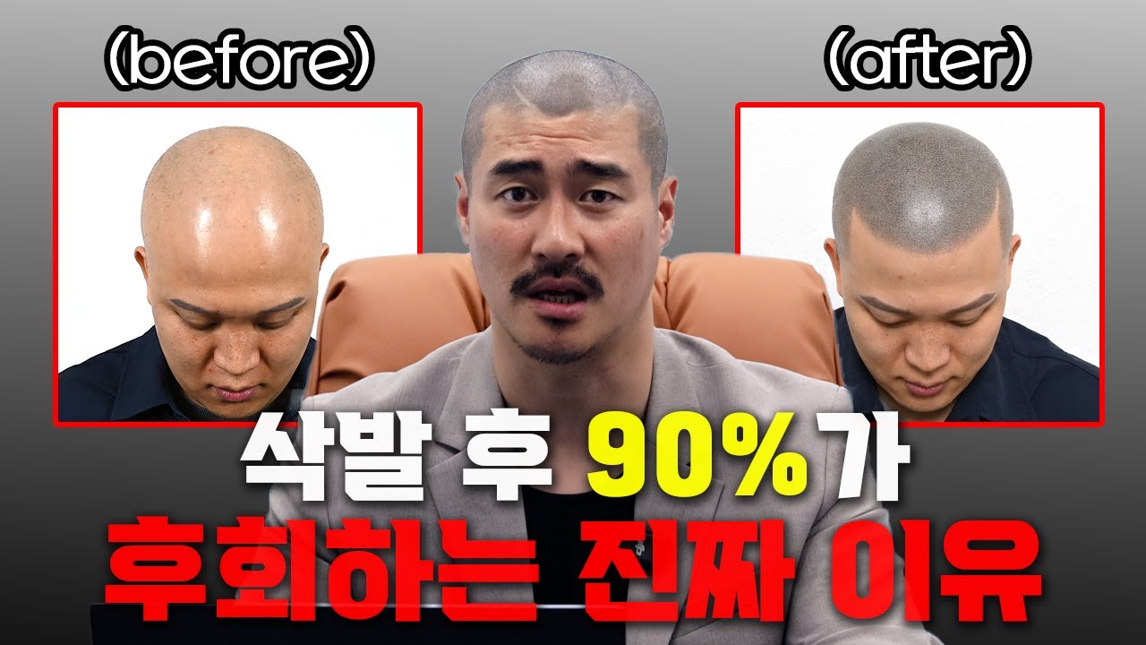 90%가 삭발 후 후회하는 이유, 바로 이것 때문입니다