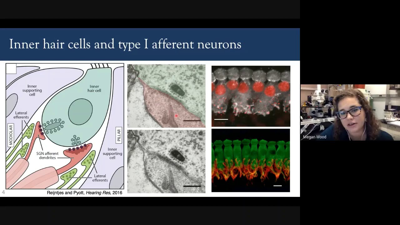 2020 Hyperacusis Webinar: Inner Ear Mechanisms of Hyperacusis with Pain