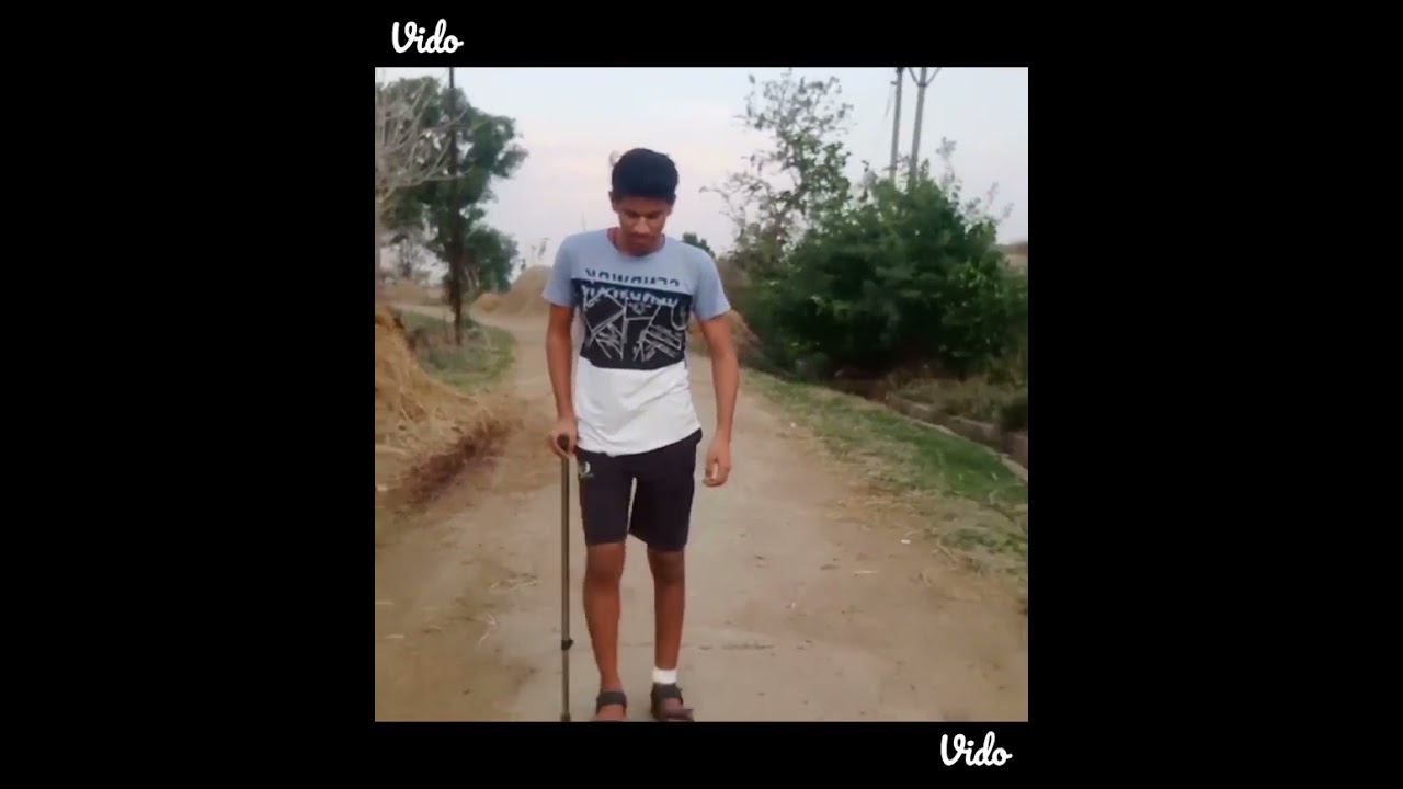 Tibia and fibula fracture recovery 3 months