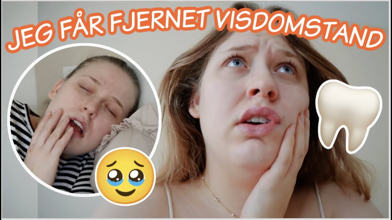 JEG FÅR FJERNET MIN VISDOMSTAND / se mig tude i 20 min.