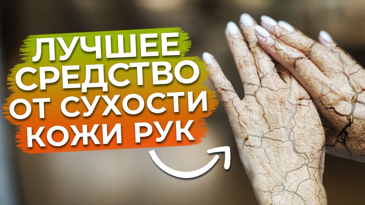 Почему сохнут и трескаются руки? / Как избавиться от сухости кожи рук навсегда?