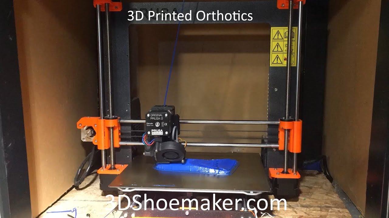 How to 3D Print Orthotics on Desktop 3D Printers