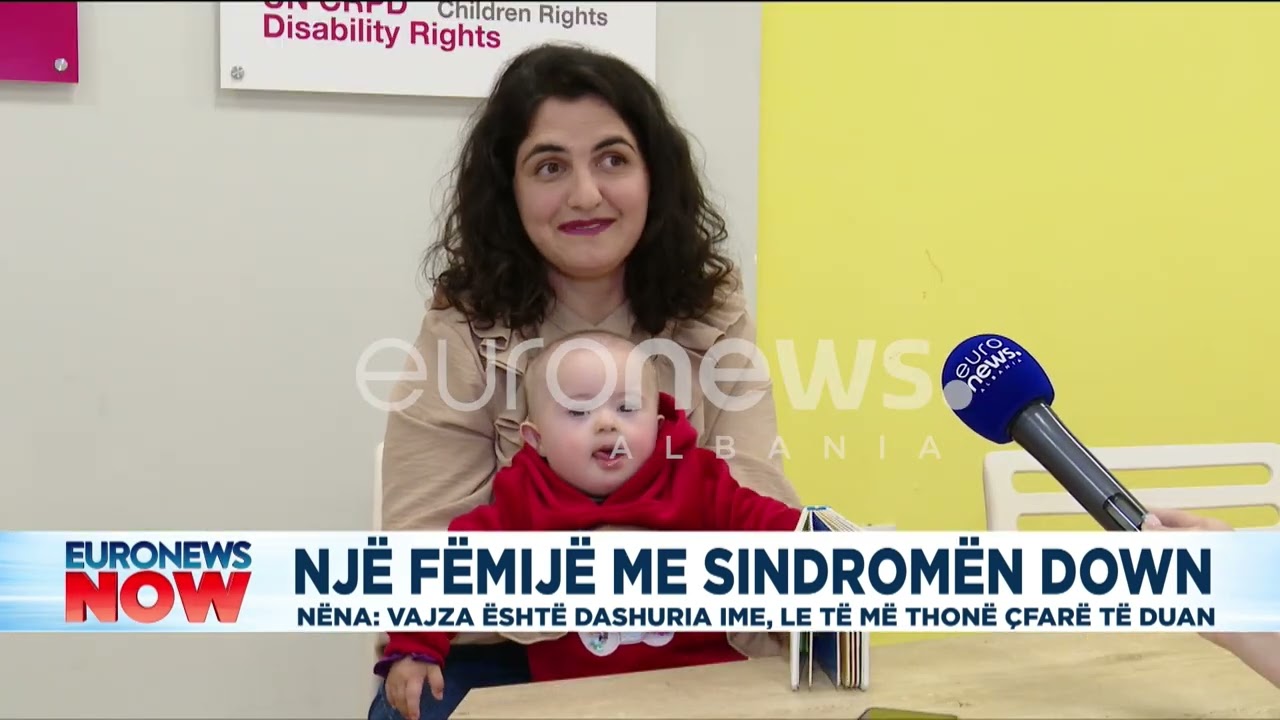 Një fëmijë me sindromën down, nëna: Është dashuria ime, le të thonë ç’të duan