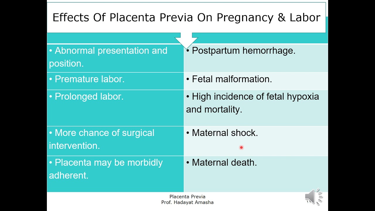 Placenta Previa