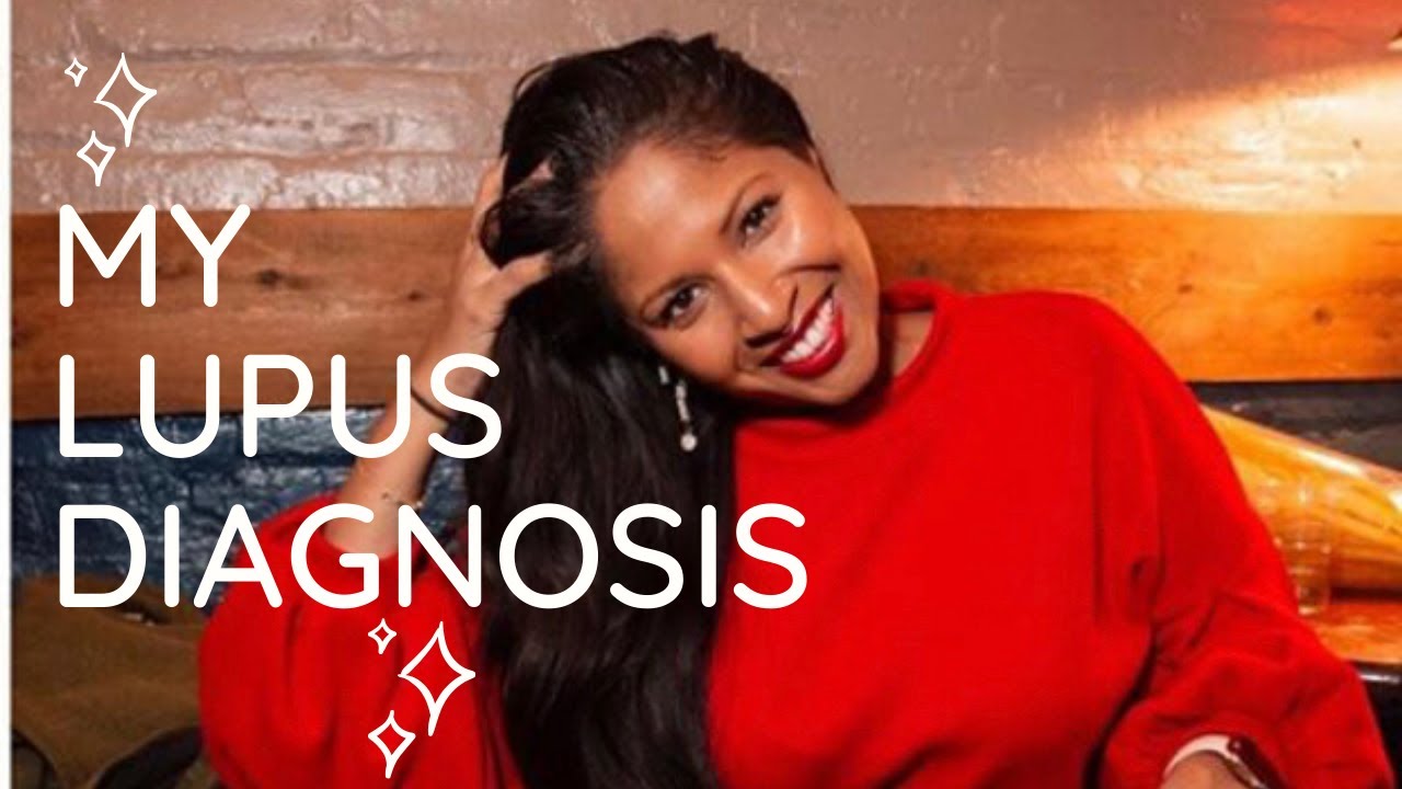 My Lupus Diagnosis