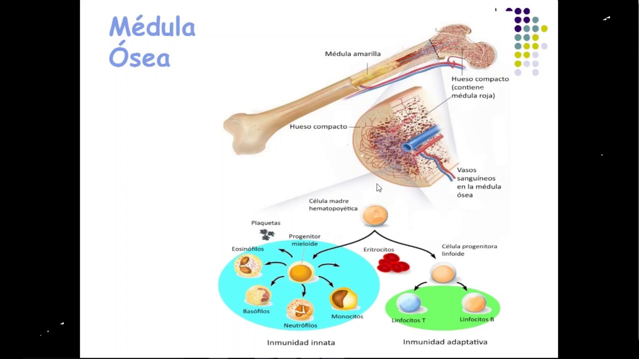 (27-06-2017) Síndromes Mielodisplásicos SMD y Leucemia Mieloide Aguda LMA