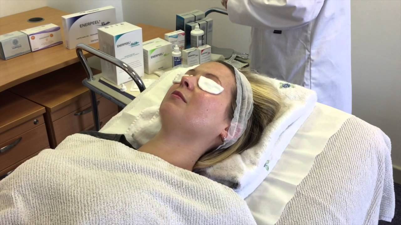 Enerpeel Mandelic Acid Training Video