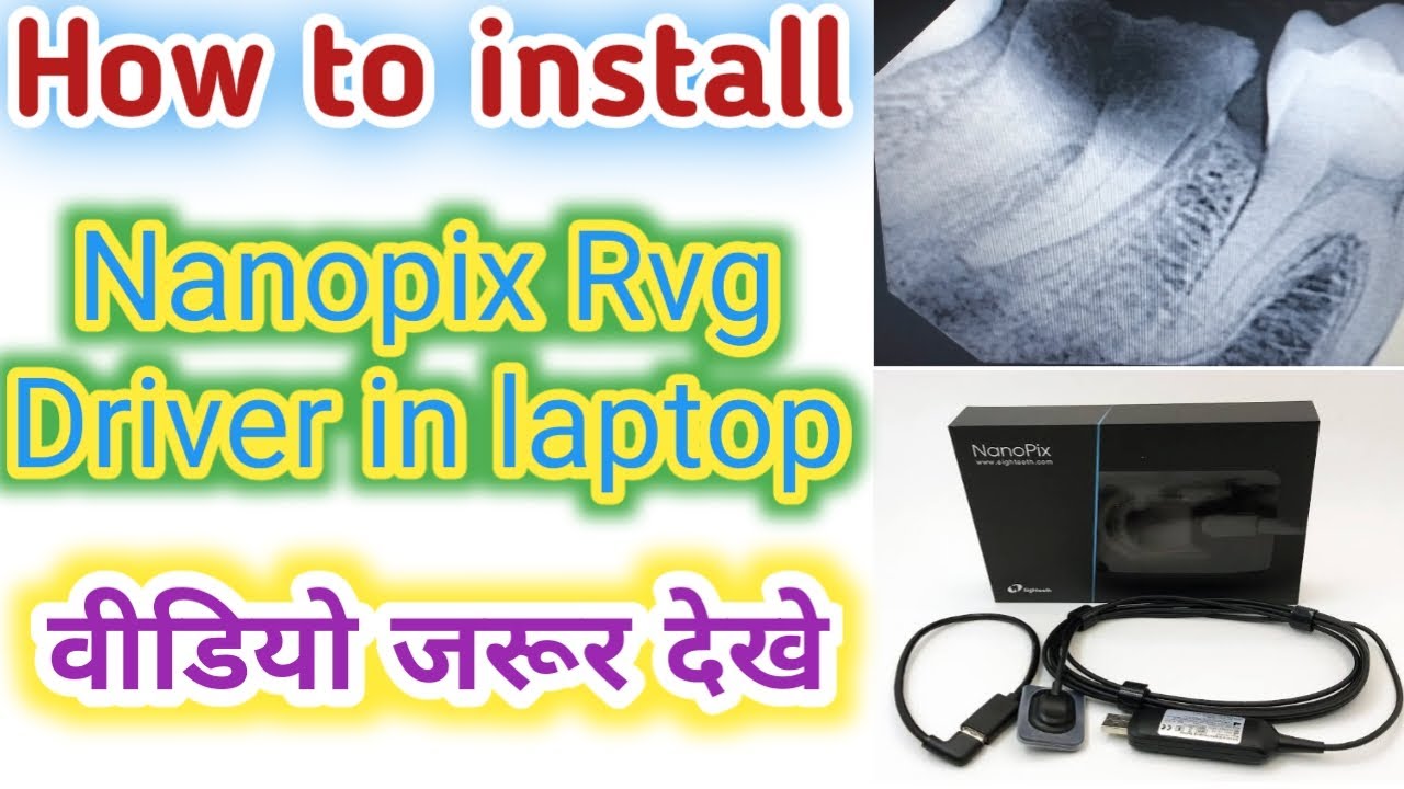 How to install Nanopix Rvg Driver in laptop/Dental bharat