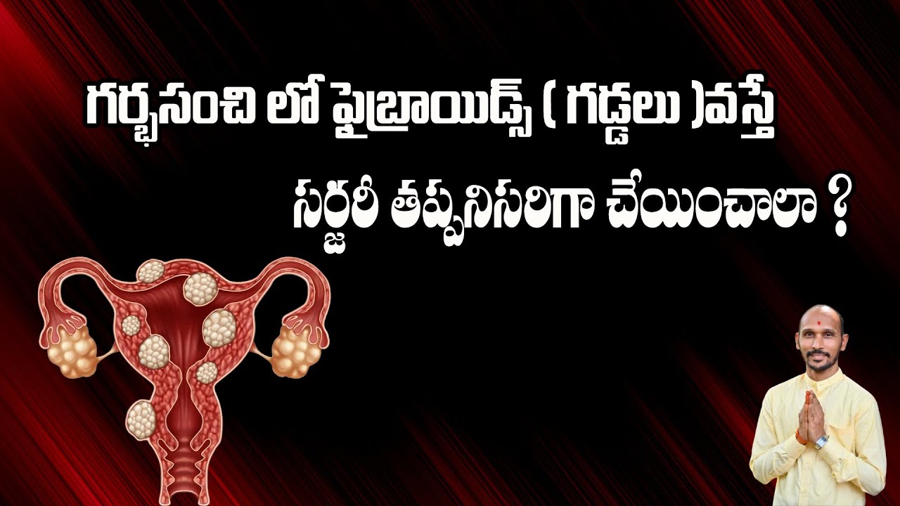 గర్భసంచి లో ఫైబ్రాయిడ్స్ ( గడ్డలు )వస్తే సర్జరీ తప్పనిసరిగా చేయించాలా ?| Dr.Madhu Babu Health Trends