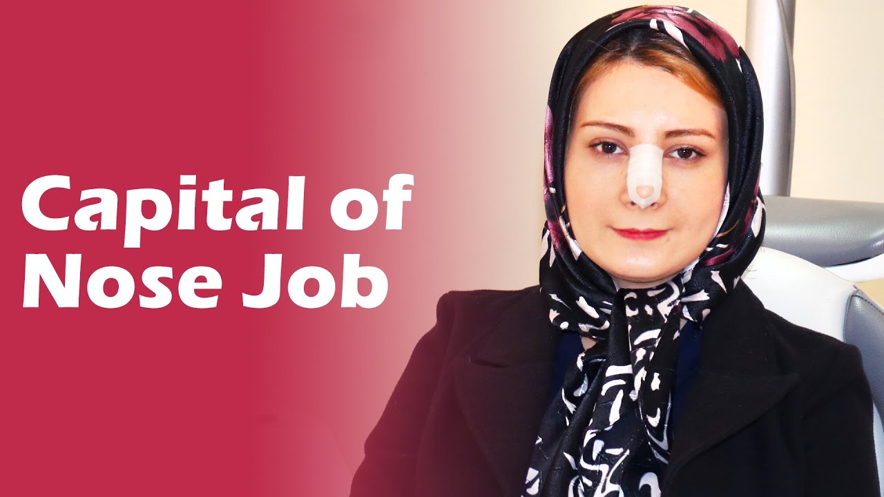 Rhinoplasty in Iran: Nose surgery story in Tehran
