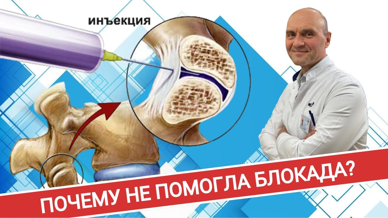 ТОП-5 ПРИЧИН, ПОЧЕМУ ВАМ НЕ ПОМОГЛА БЛОКАДА