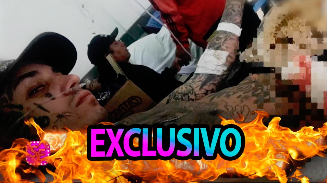 ¡Exclusivo! Eloy Rivera detalla cómo fue la pelea donde terminó apuñalado y relata su versión