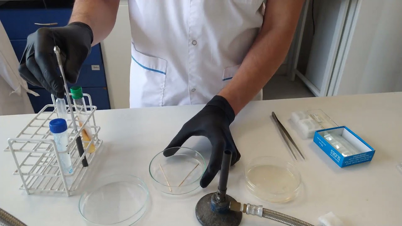 T&eacute;cnica de Microcultivo