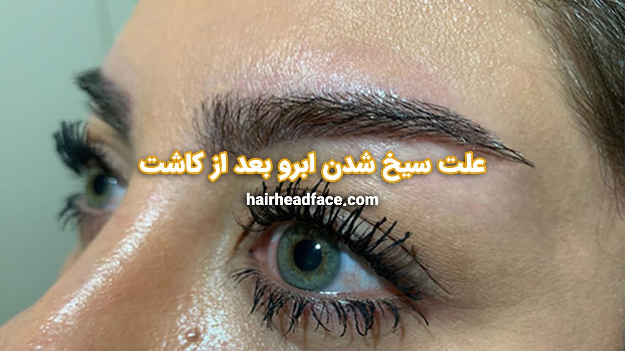 علت سیخ شدن ابرو بعد کاشت ابرو طبیعی
