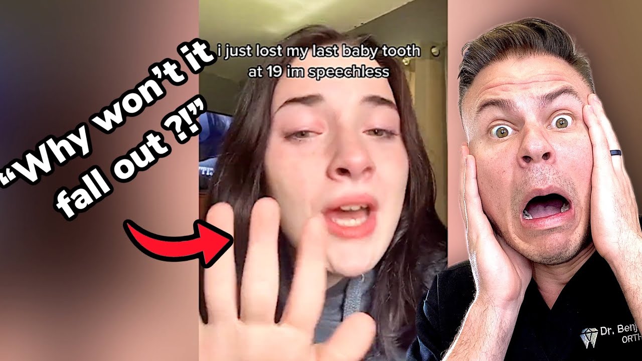 19 Year Old Baby Tooth?! Orthodontist Reacts!