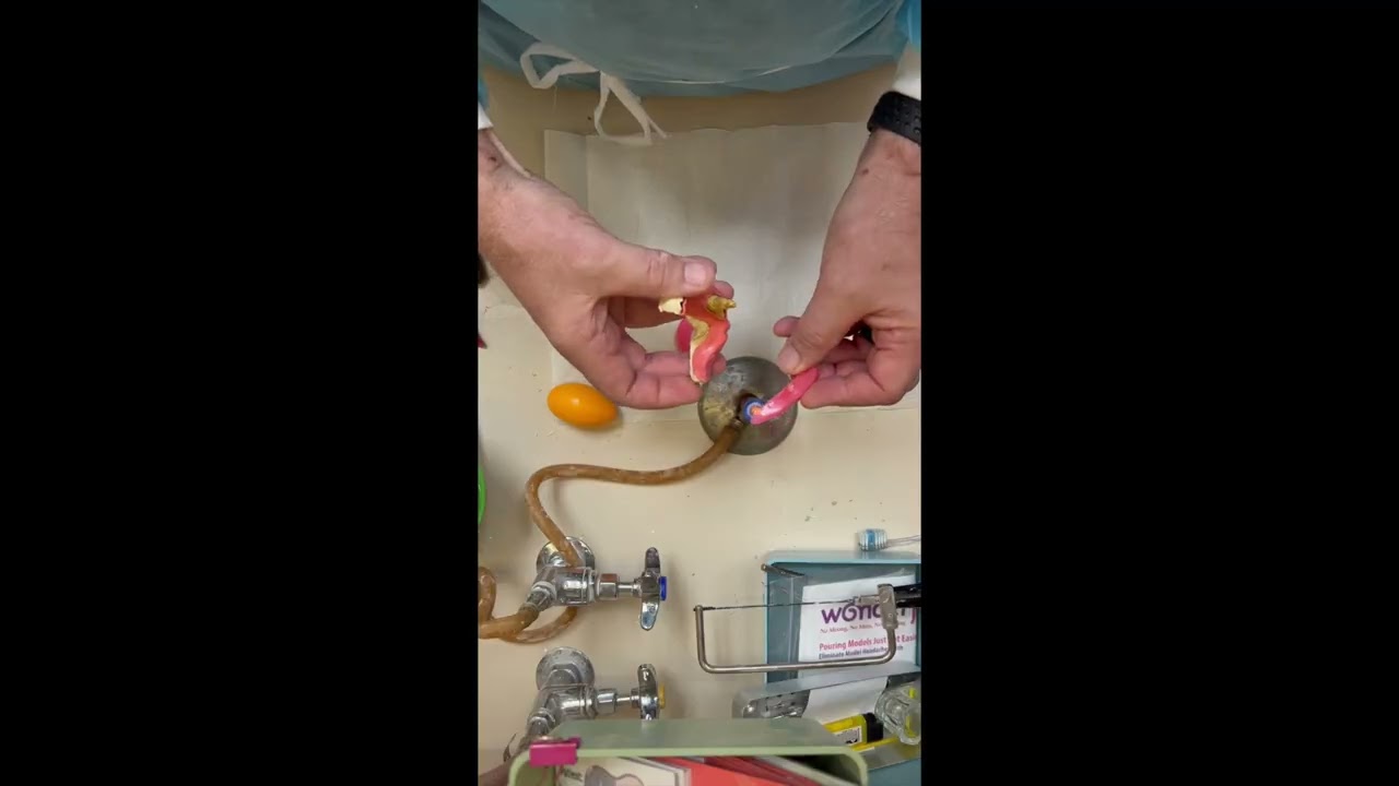 DYI DENTURE baseplates and wax rims
