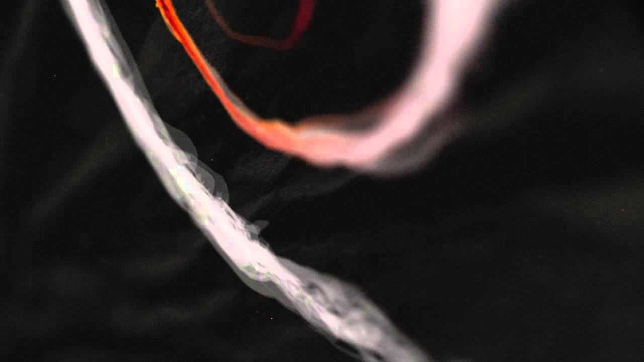 Stephan Hinz & Clint Stewart - Shimmer