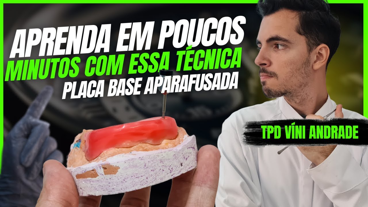 APRENDA O PASSO A PASSO PARA UMA PLACA BASE APARAFUSADA EM APENAS 15 MINUTOS // PROTOCOLO DENTARIO
