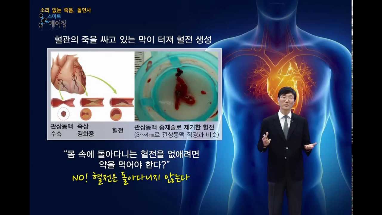 으랏차차_심장질환 편_소리없는 죽음, 돌연사 - 순환기내과 권현철 교수[의료진 ON Line 강의]