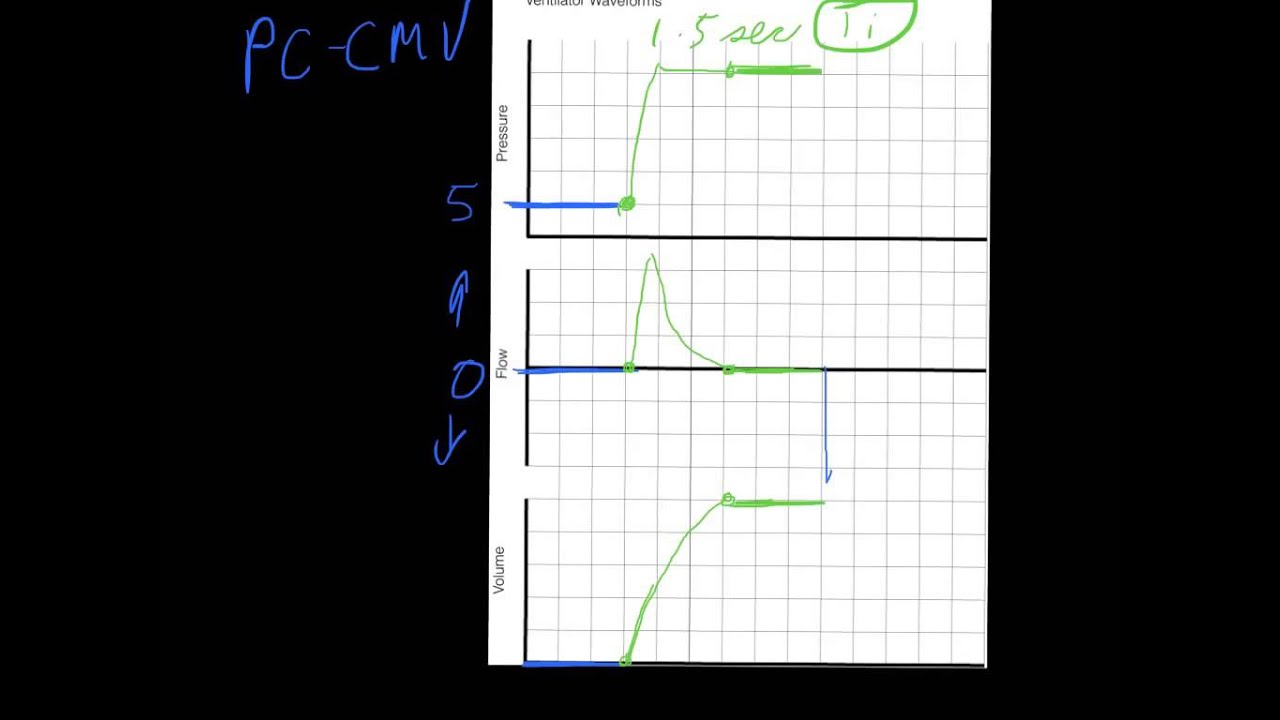 Ventilator Mode & Waveforms Review