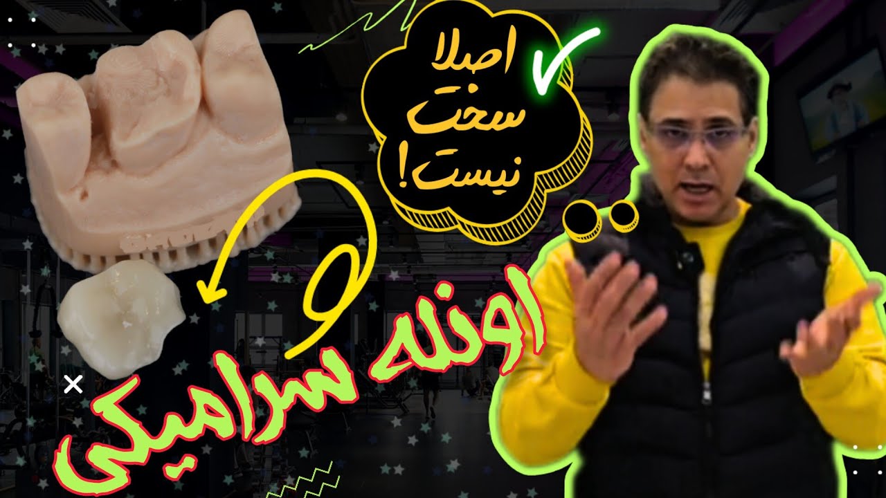 اینله و اونله، ترمیم های سرامیکی غیرمستقیم  دندان| آماده سازی دندان و ساخت بایوبیس