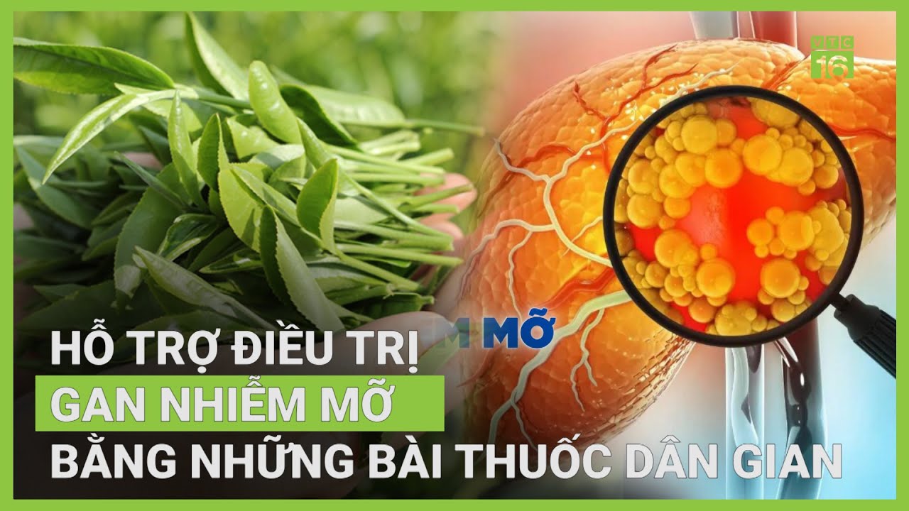 Lá chè xanh có giảm được gan nhiễm mỡ? | VTC16