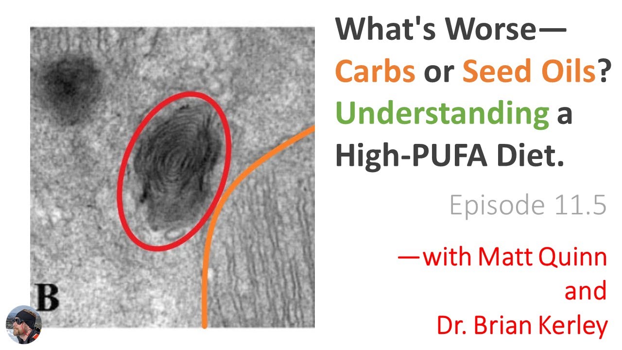 Ep. 12: What's Worse—Carbs or Seed Oils? Understanding a Hi-PUFA Diet—w/ Brian Kerley & Matt Quinn