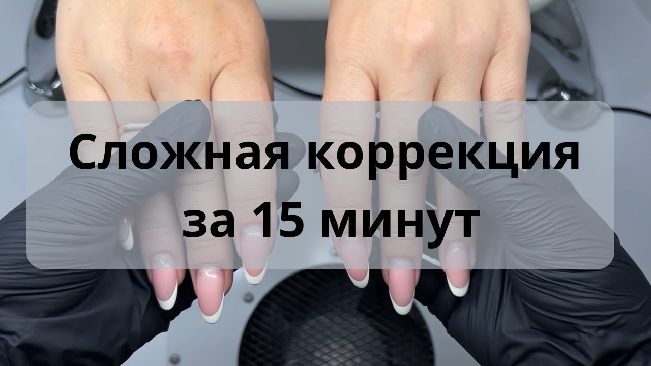 Поднимаем клюющие ногти за 15 минут