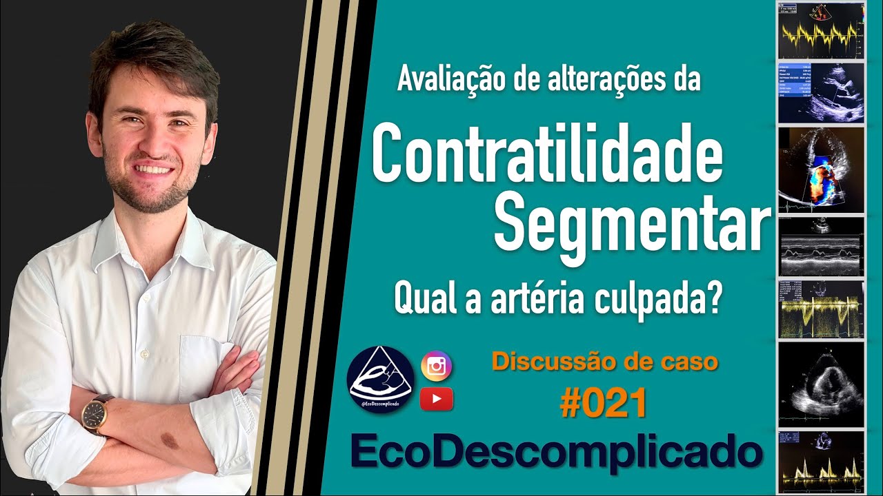 EcoDescomplicado - Discussão de caso AO VIVO #021 - Avaliando Alterações da Contratilidade Segmentar