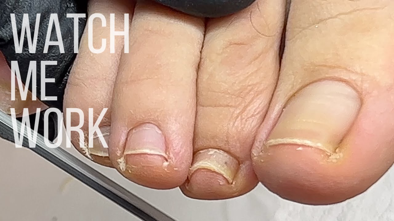 Wellness Pedicure: Detailing deep side walls, gentle dry pedi technique [Watch Me Work]