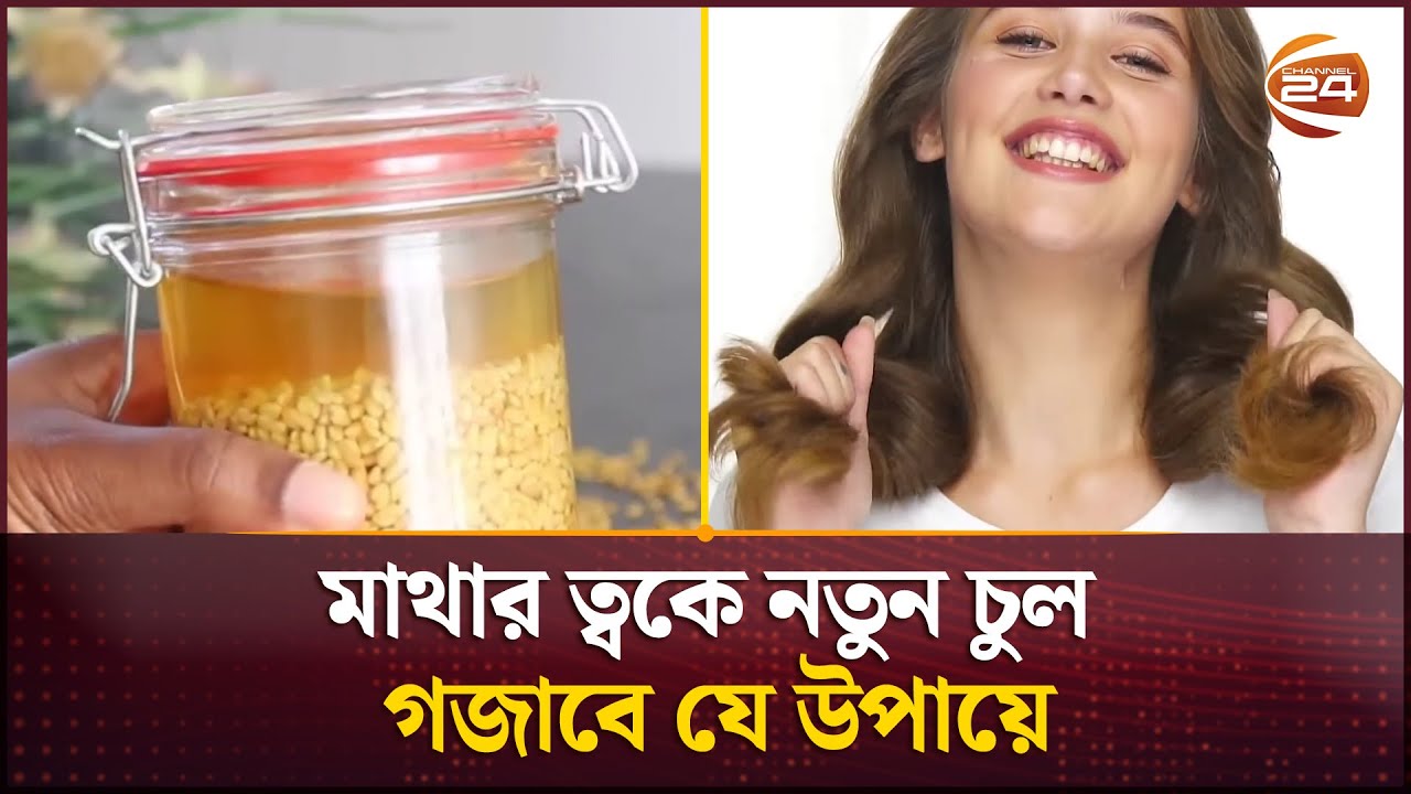 মাথার ত্বকে নতুন চুল গজাবে যে উপায়ে | The best home remedies for hair growth | Channel 24
