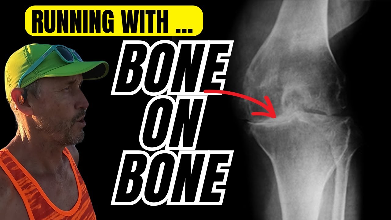 HOW I RUN WITH BONE ON BONE KNEE PAIN