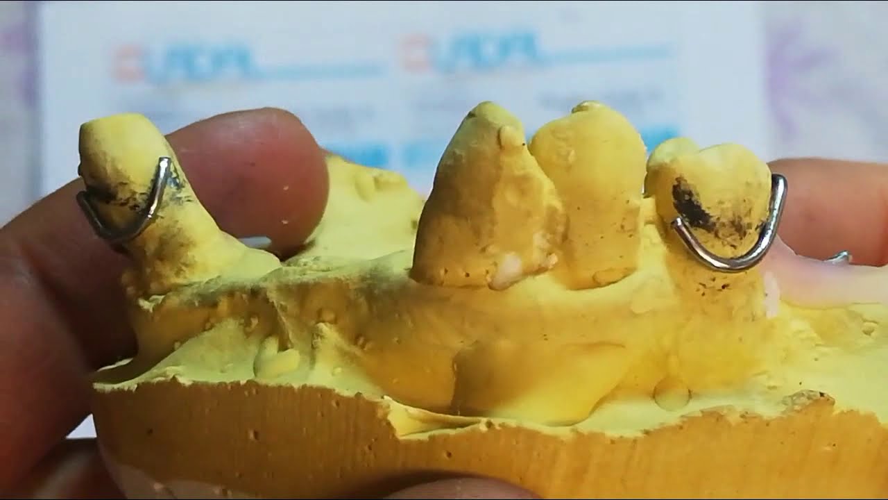 GANCHOS DENTALES FORJADOS