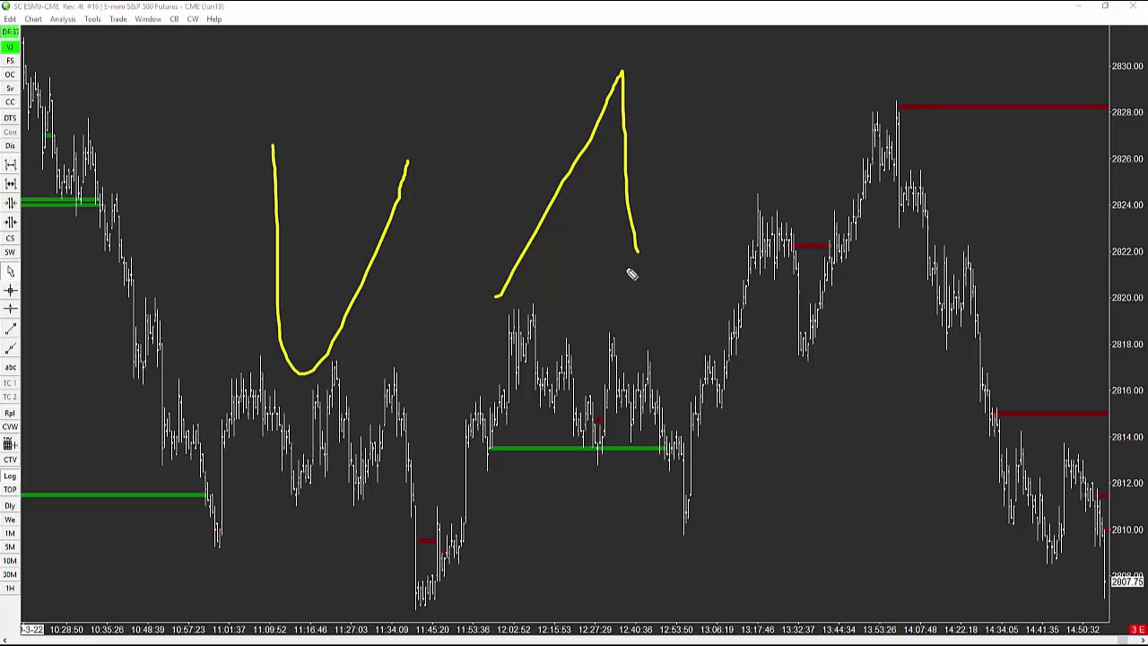 ETG Problems with some Patterns