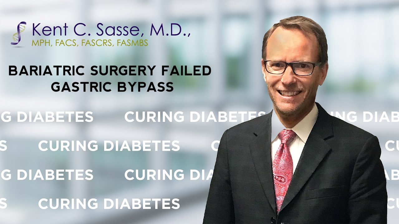 Why Did My Gastric Bypass Fail? Here's What Dr. Sasse Wants You to Know
