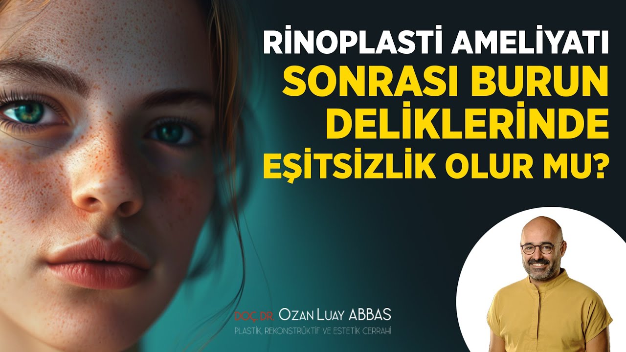 Rinoplasti Sonrası Burun Deliklerinde Eşitsizlik Olur mu? | Doç. Dr. Ozan Luay ABBAS